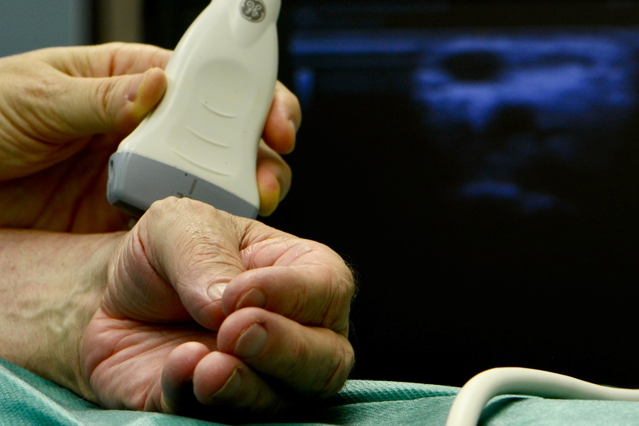 Ein Ultraschal am Unterarm einer Patientin
