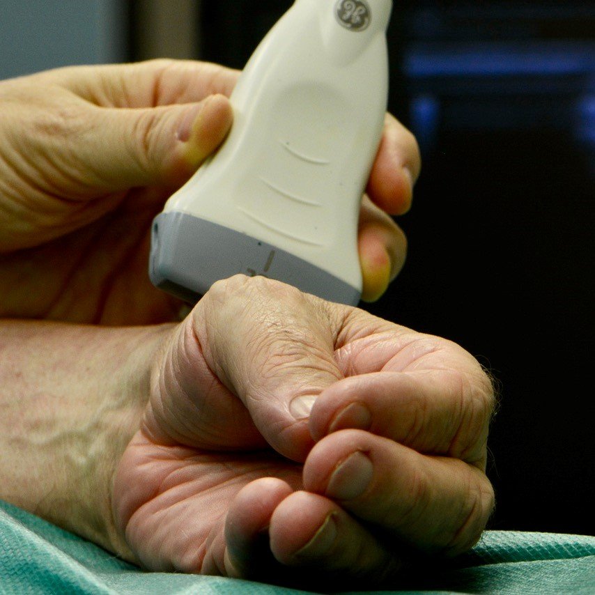 Ein Ultraschal am Unterarm einer Patientin