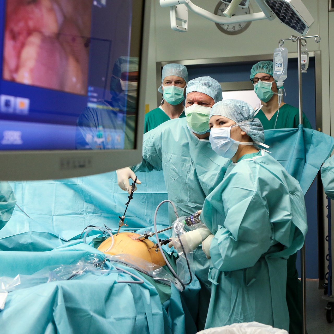 Ein Ärzteteam operiert einen Bauch, es werden Instrumente gehalten und konzentriert auf einen Bildschirm geschaut