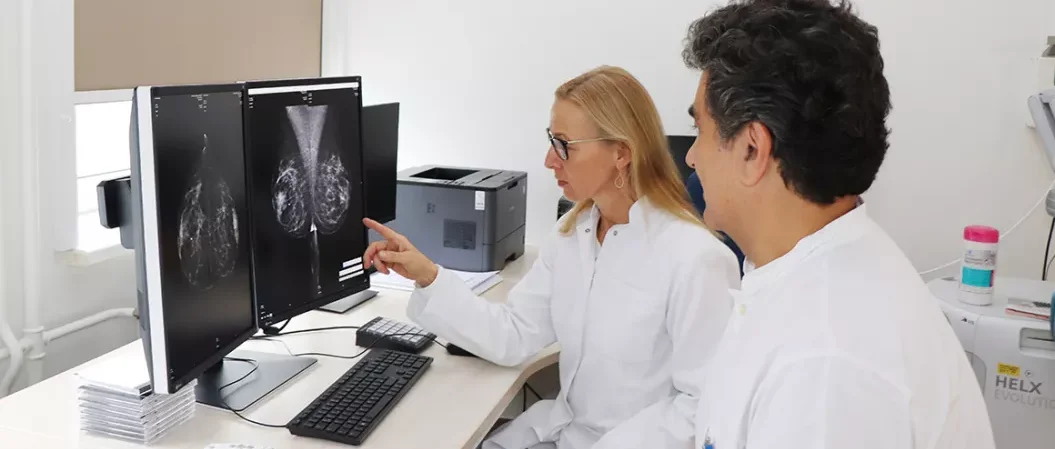Zwei Ärzt:innen in weißen Kitteln betrachten konzentriert zwei Mammographie-Aufnahmen auf Computerbildschirmen. Eine Ärztin zeigt mit dem Finger auf ein Detail.