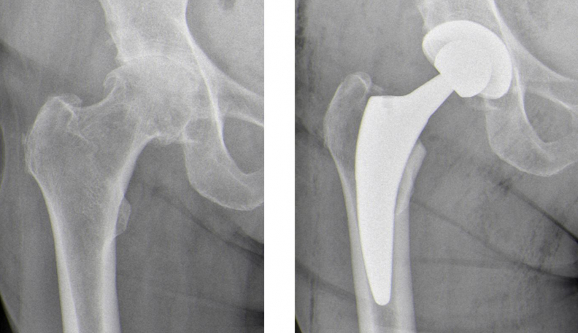 endoprothetik-an-h-fte-und-knie-krankenhaus-reinbek