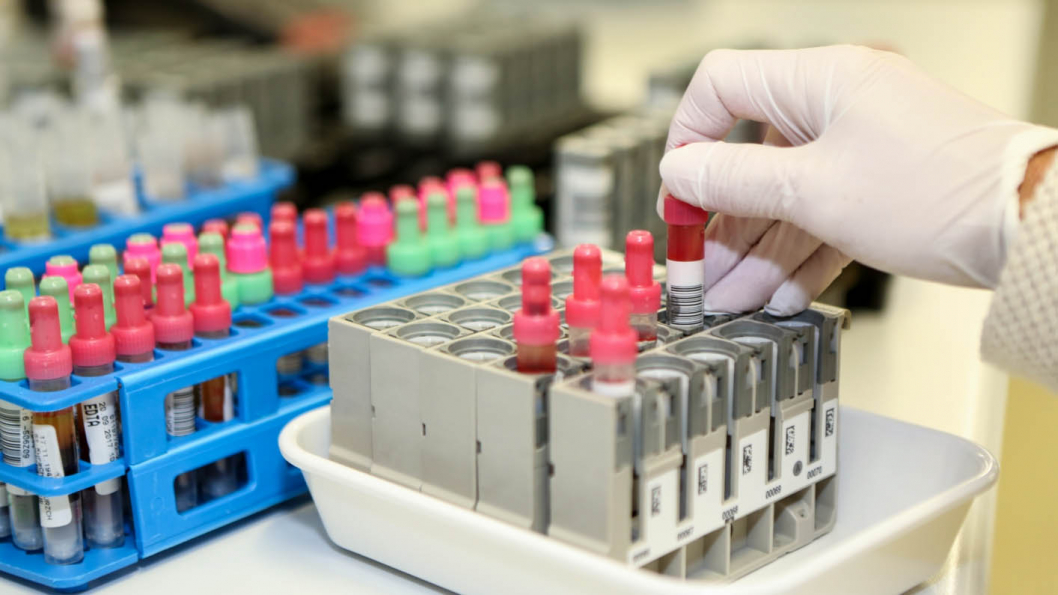Lab Details 0155 2064 Lab Details 0155 2064